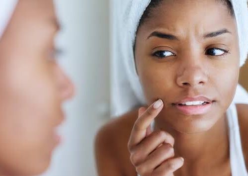 Is Your Skin Barrier Damaged? Here’s How to Tell and How to Fix It.