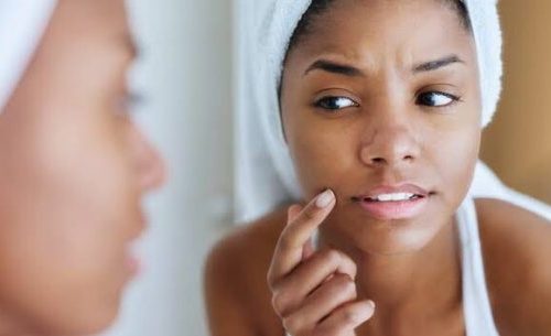 Is Your Skin Barrier Damaged? Here’s How to Tell and How to Fix It.